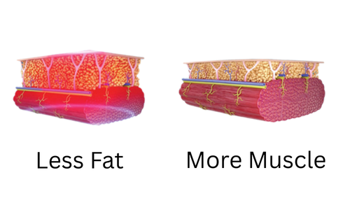 What Is EMSCULPT NEO®?